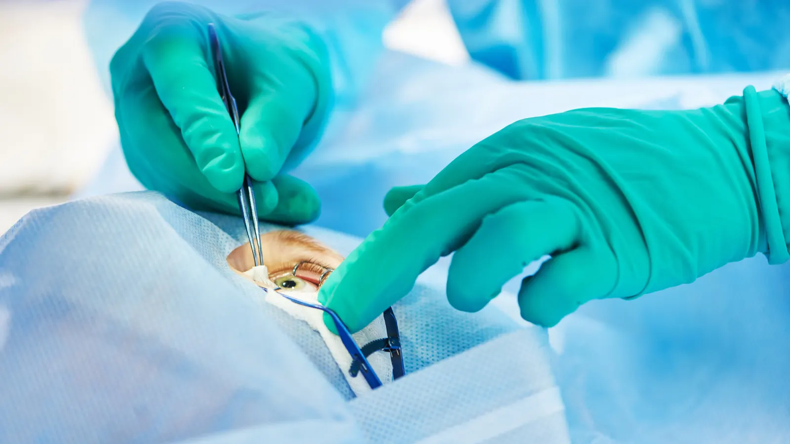 Cataract surgery information graphic